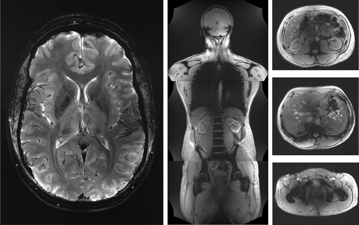 7T images of human brain and body