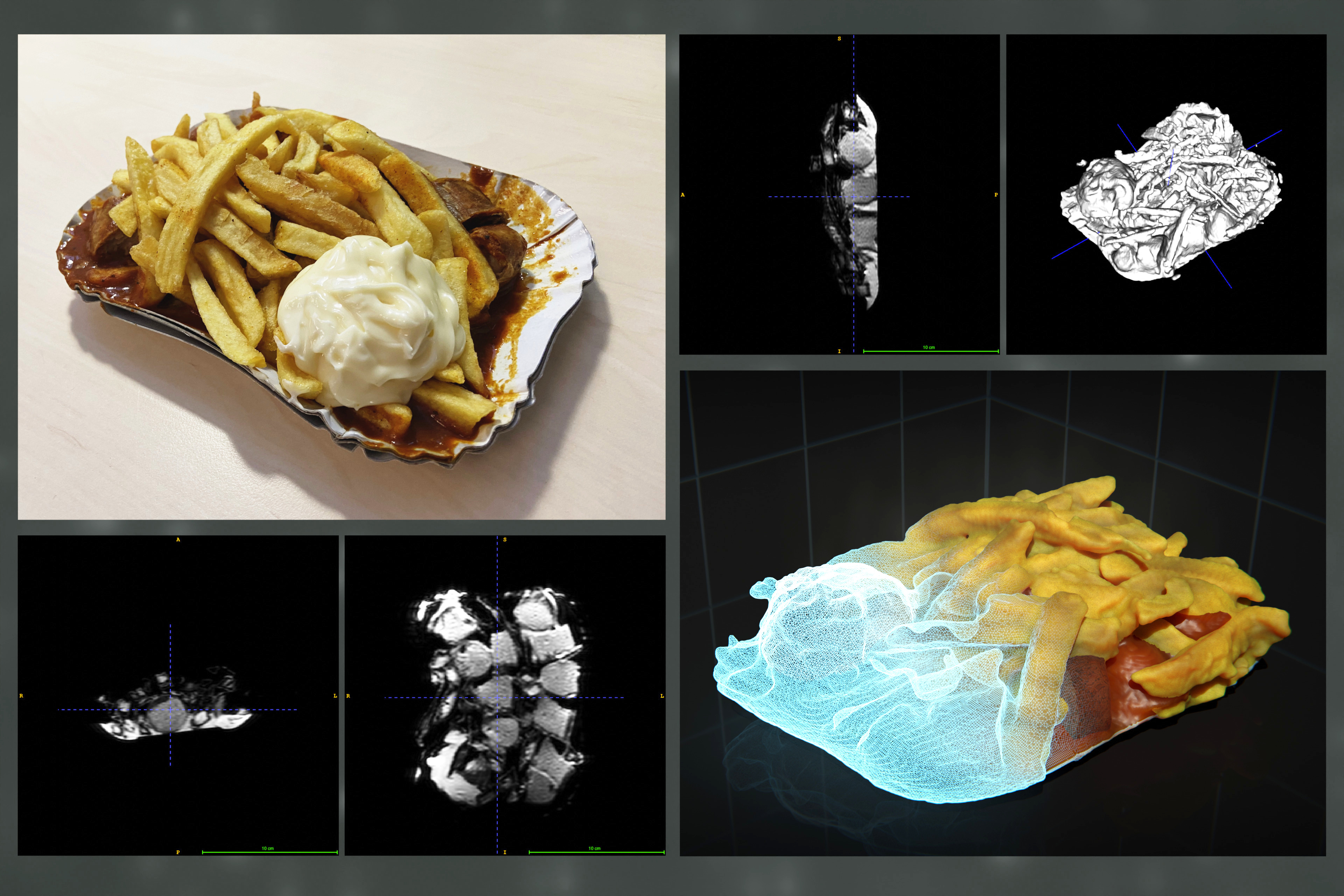 From Cravings to Ingestion: The Brain-Body-Axis revealed through a 7-Tesla MRI Portrait of CPM