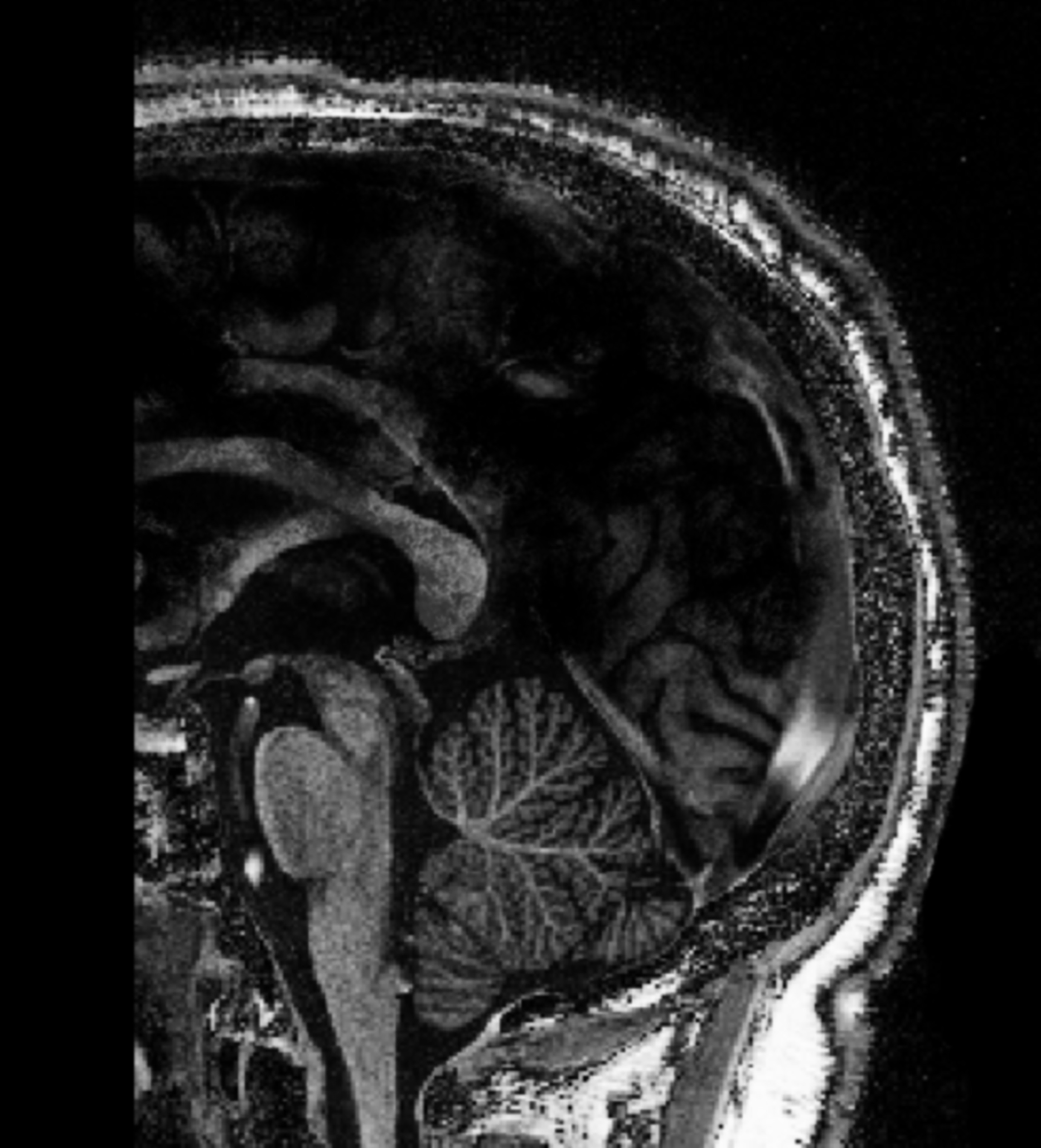 The Cerebellum in the Spotlight